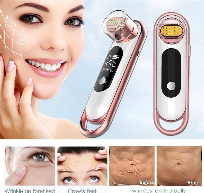 Thermo RF Skin Rejuvenation Face Massager